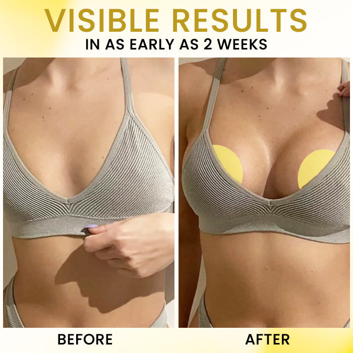 AEXZR® Apex-Lift Volumizing & Lifting Microneedle Bust Patch✨ The Micro-Needle Revolution: Rebuilds Your Breast's Inner Scaffolding for a Natural, Non-Surgical Lift.