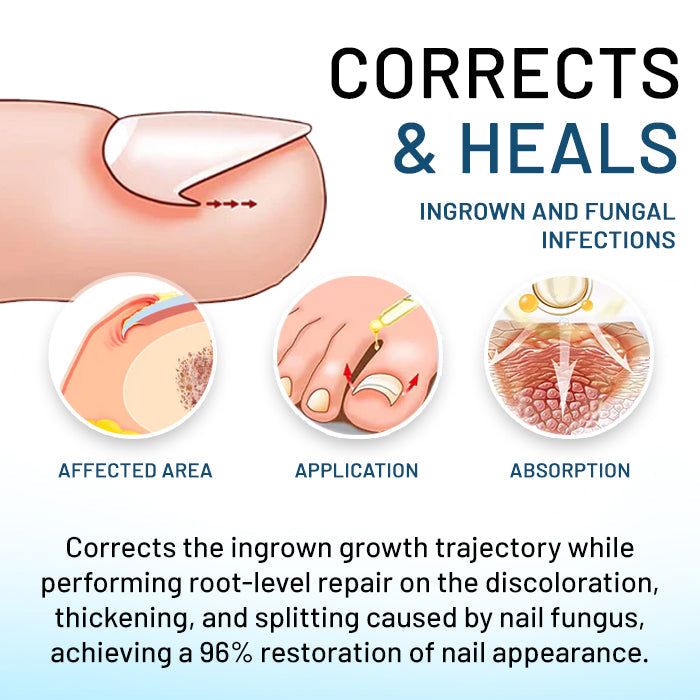 AEXZR® Bio-Soft Nano-Regeneration Liquid 💎💎 From Agony to Relief: Get Doctor-Level Results for Ingrown Nails & Fungus, Naturally.