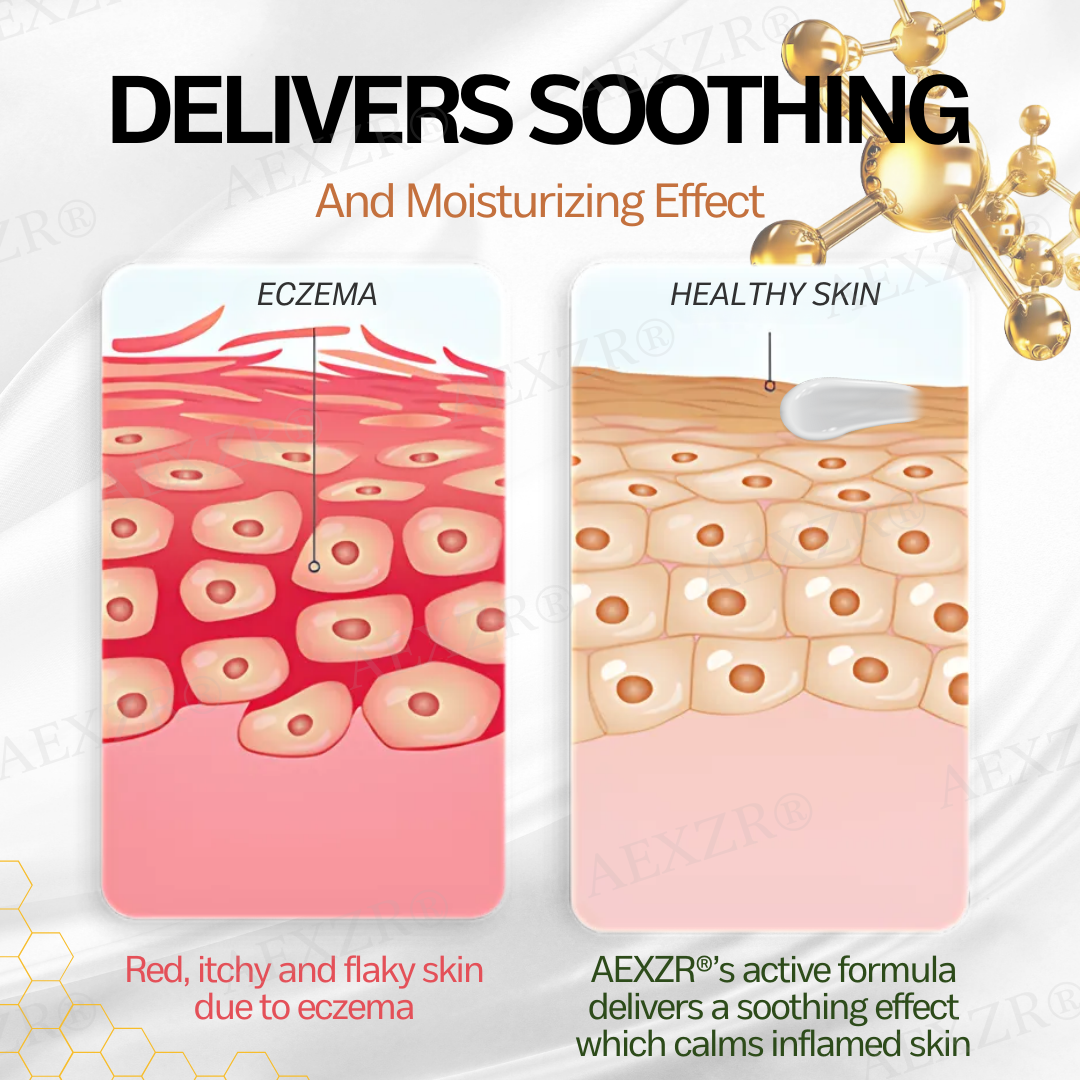 AEXZR® New Zealand Manuka Honey Eczema Treatment Cream🎯 Soothe the Rage, Reclaim Your Skin