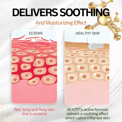 AEXZR® New Zealand Manuka Honey Eczema Treatment Cream🎯 Soothe the Rage, Reclaim Your Skin