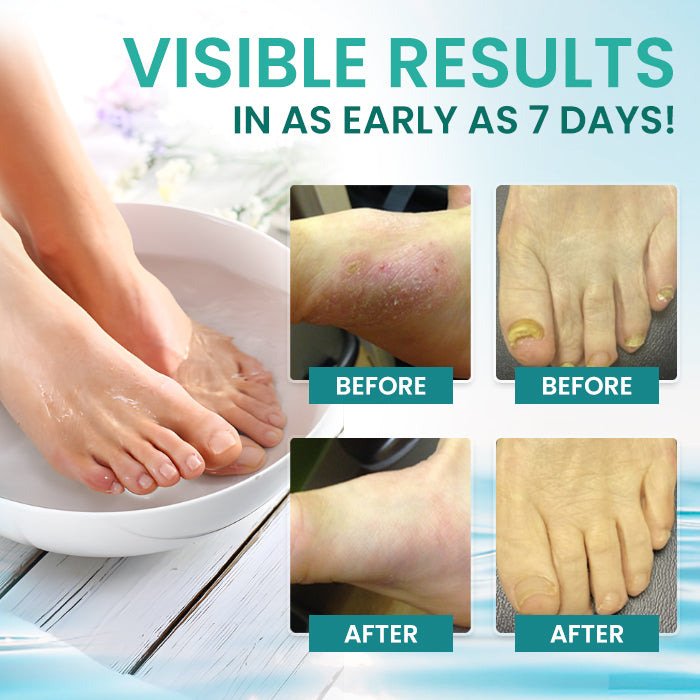 AEXZR® ItchBreak Sea Salt Soak✨ Your Clinical-Grade Foot Spa: The Triple-Action Soak That Eradicates Itch & Fungus For Good.