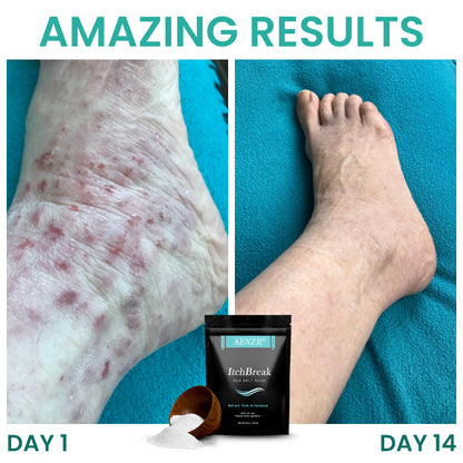 AEXZR® ItchBreak Sea Salt Soak✨ Your Clinical-Grade Foot Spa: The Triple-Action Soak That Eradicates Itch & Fungus For Good.
