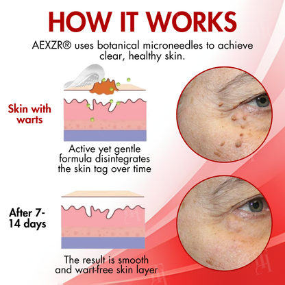 AEXZR® Nano-Microdart Skin Tag & Spot Corrector Patches🎯 Clear Skin, No Clinic Needed 🎯