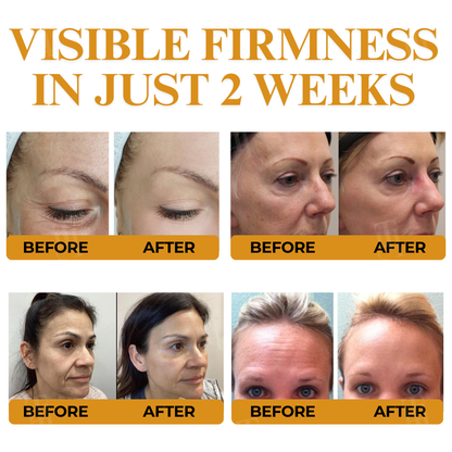 AEXZR® Letybo Bee Venom Wrinkle Removal Cream🐝 The Bee-Venom Peptide Revolution: Mimics Letybo’s Effects Without Needles for “Botox-Like” Smoothing.