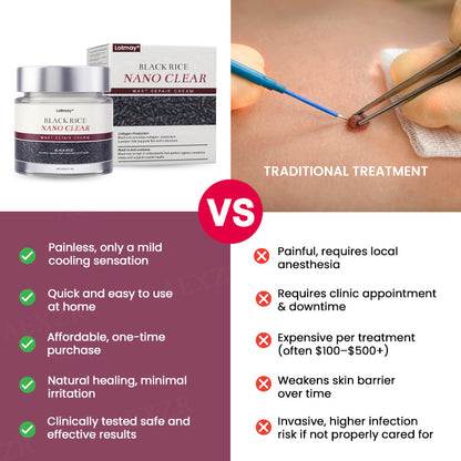 Lotmay® BlackRice Nano Clear Wart Repair Cream 🧬 The Deep-Rooted Solution: Erases Skin Growths from the Source, No Pain, No Scars.