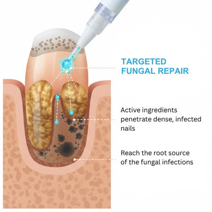 AEXZR® NanoFix Nail Repair Pen 🧬 *The Nano-Penetration System: Eradicates Fungus at The Root in Just 5 Days.*