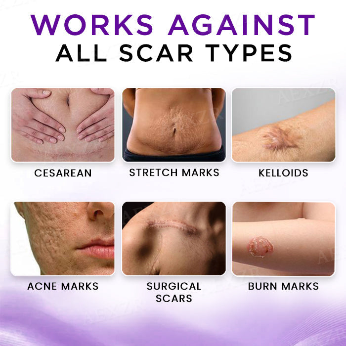 AEXZR® Cure Face & Body Scar Gel✨Skin Stories Rewritten