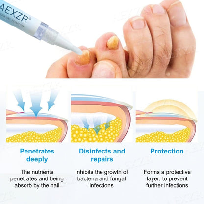 AEXZR® NanoFix Nail Repair Pen 🧬 *The Nano-Penetration System: Eradicates Fungus at The Root in Just 5 Days.*