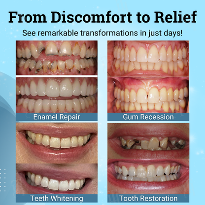AEXZR® Non-Surgical Gum "Suture" Gel🧬 Nano-Lattice “Suture” Tech: Regrows Tight Gums & Secures Loose Teeth in 5 min — No Drill, No Graft.