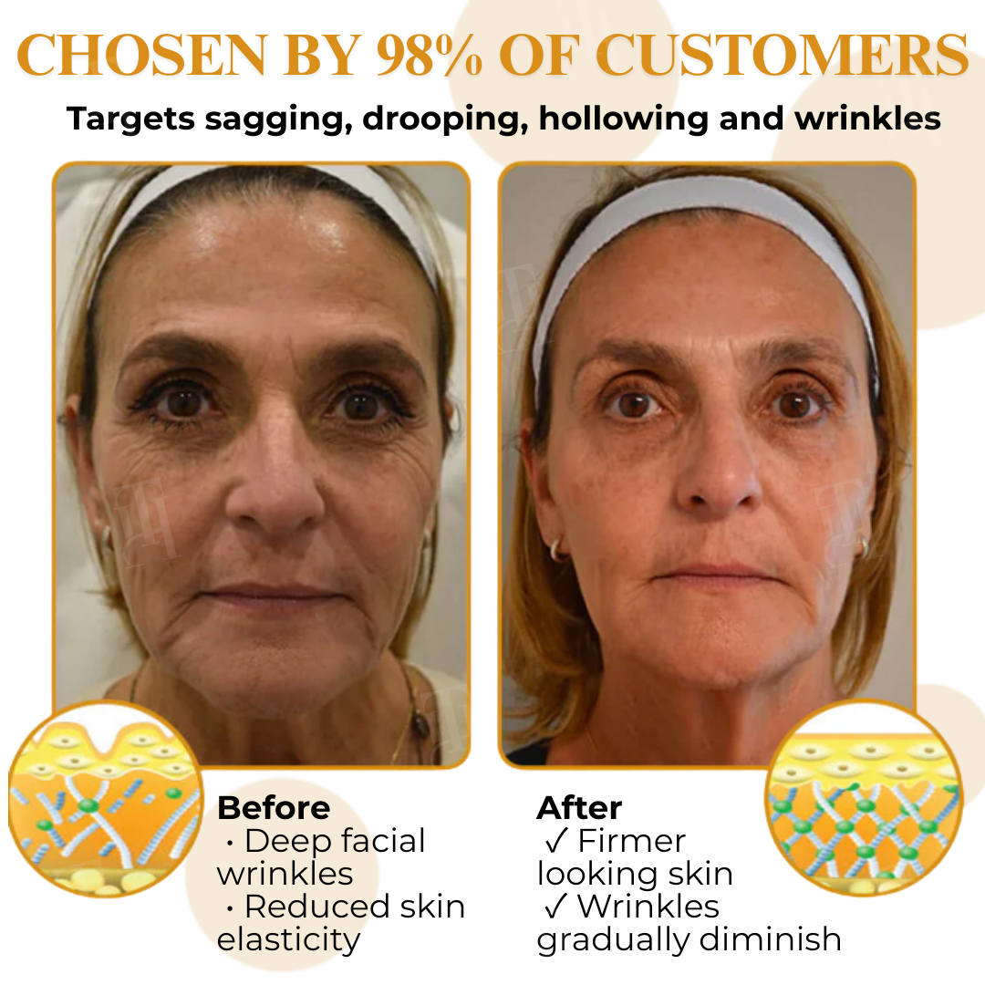 AEXZR® Letybo Bee Venom Wrinkle Removal Cream🐝 The Bee-Venom Peptide Revolution: Mimics Letybo’s Effects Without Needles for “Botox-Like” Smoothing.