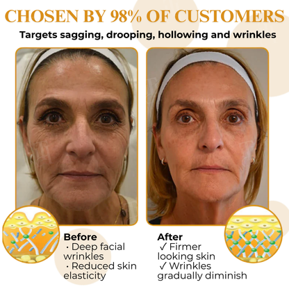 AEXZR® Letybo Bee Venom Wrinkle Removal Cream🐝 The Bee-Venom Peptide Revolution: Mimics Letybo’s Effects Without Needles for “Botox-Like” Smoothing.