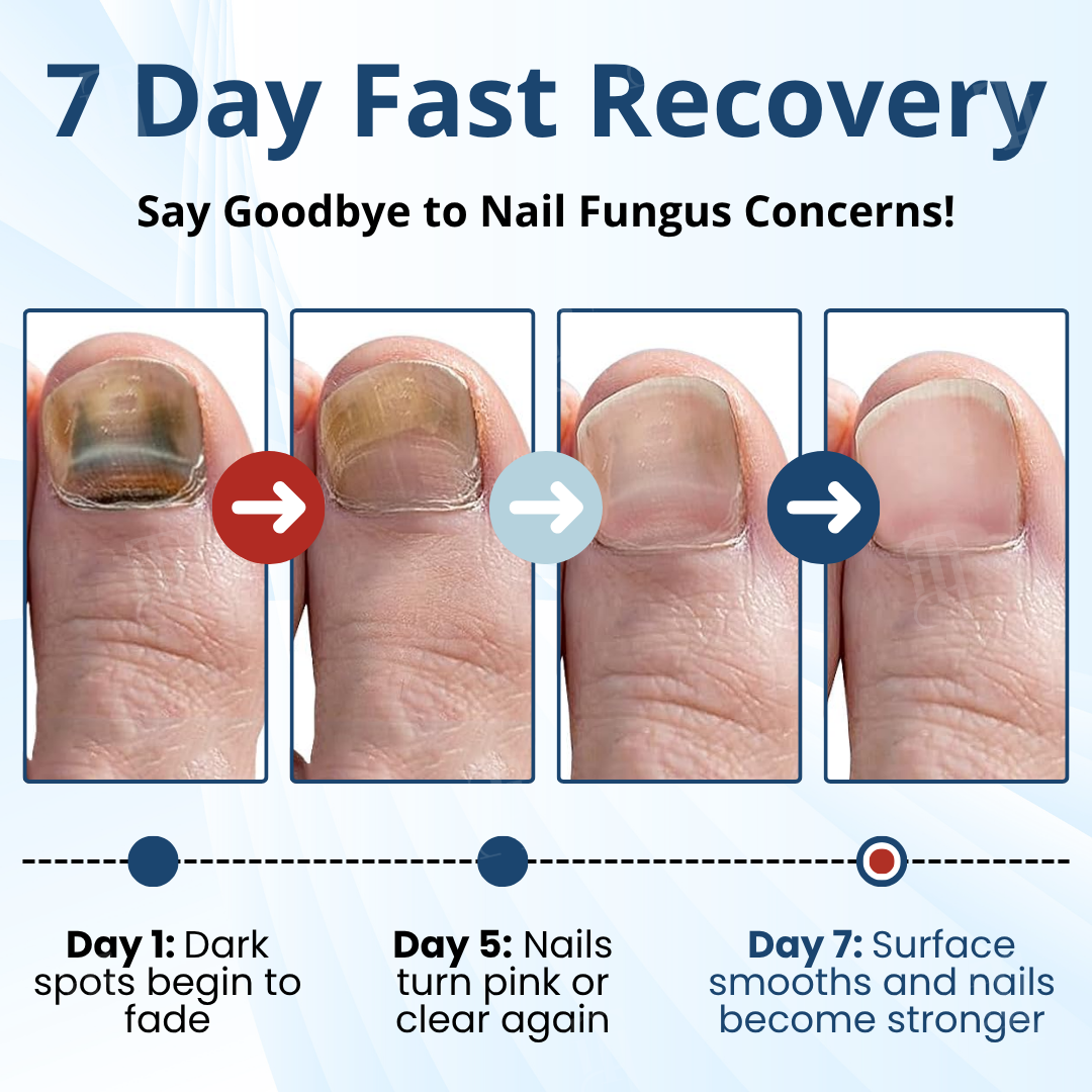 AEXZR® MycoShield Pro Fungal Nail Patches🧪 The Hydrogel Occlusion Breakthrough: Melts Through the Keratin Wall in 2 Nights for Deeper Repair.