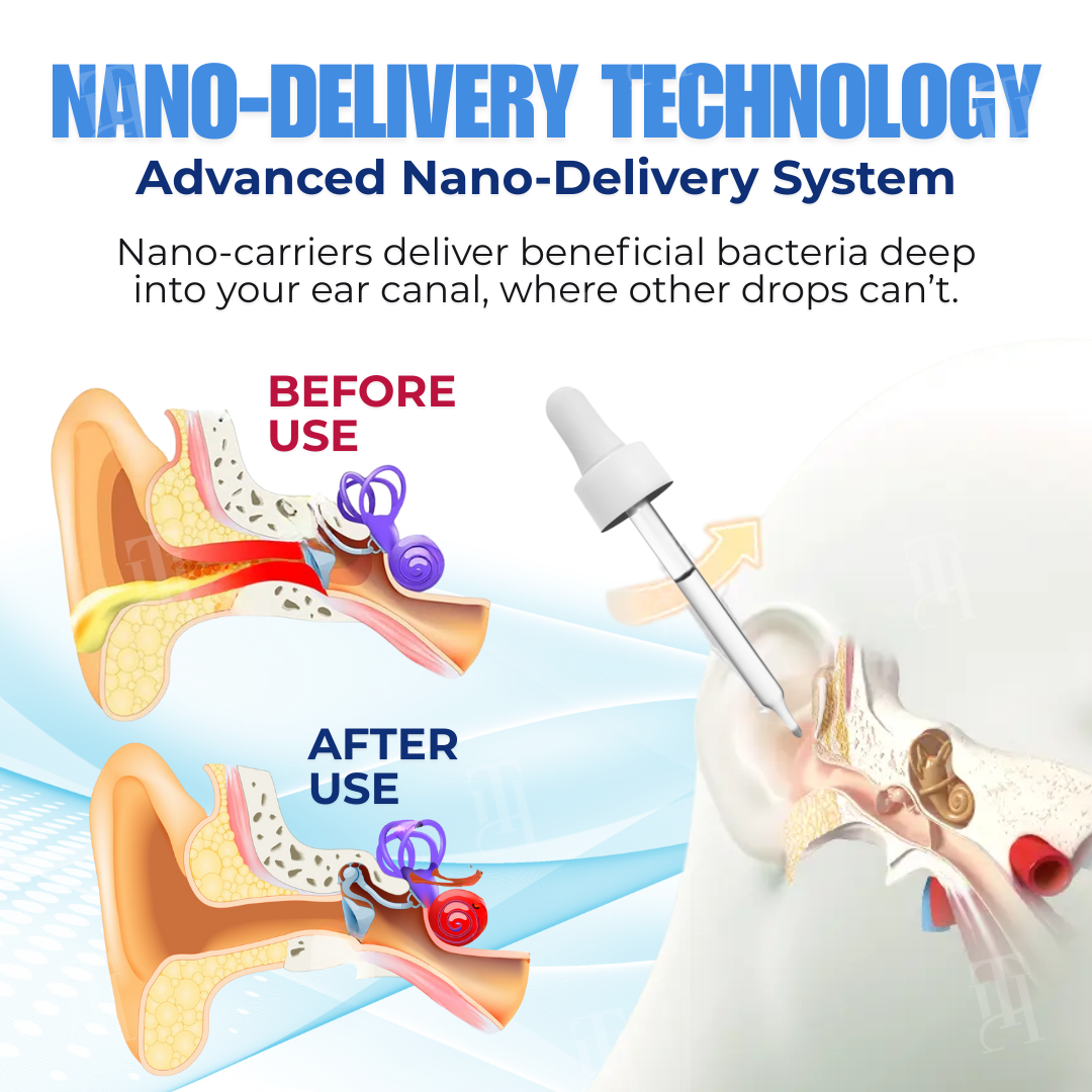 AEXZR® NanoTecta Otic Care Drop⚡ Targets the Root, Not the Ring: Rebal ...