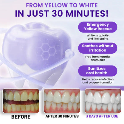 AEXZR® V34 Whitening Strips⚡ The 30-Minute White Rescue: See Results Before Your Mirror Fogs Up.