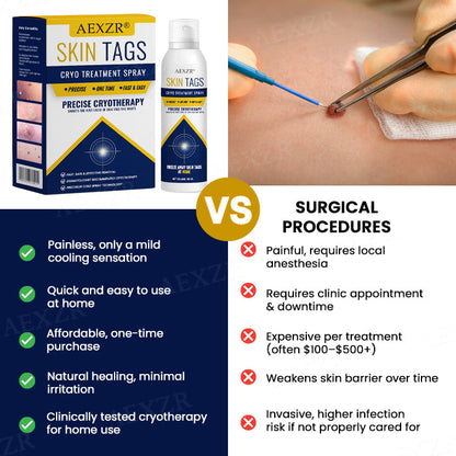 🥚 Easter Deal AEXZR® Skin Tag Cryo Treatment Spray🧊 Precision Cryo-Tech: Freezes Away Skin Tags & Warts in Seconds – No Blades, No Pain.