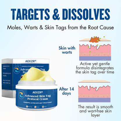 AEXZR® Advanced Skin Tag Protocol Cream