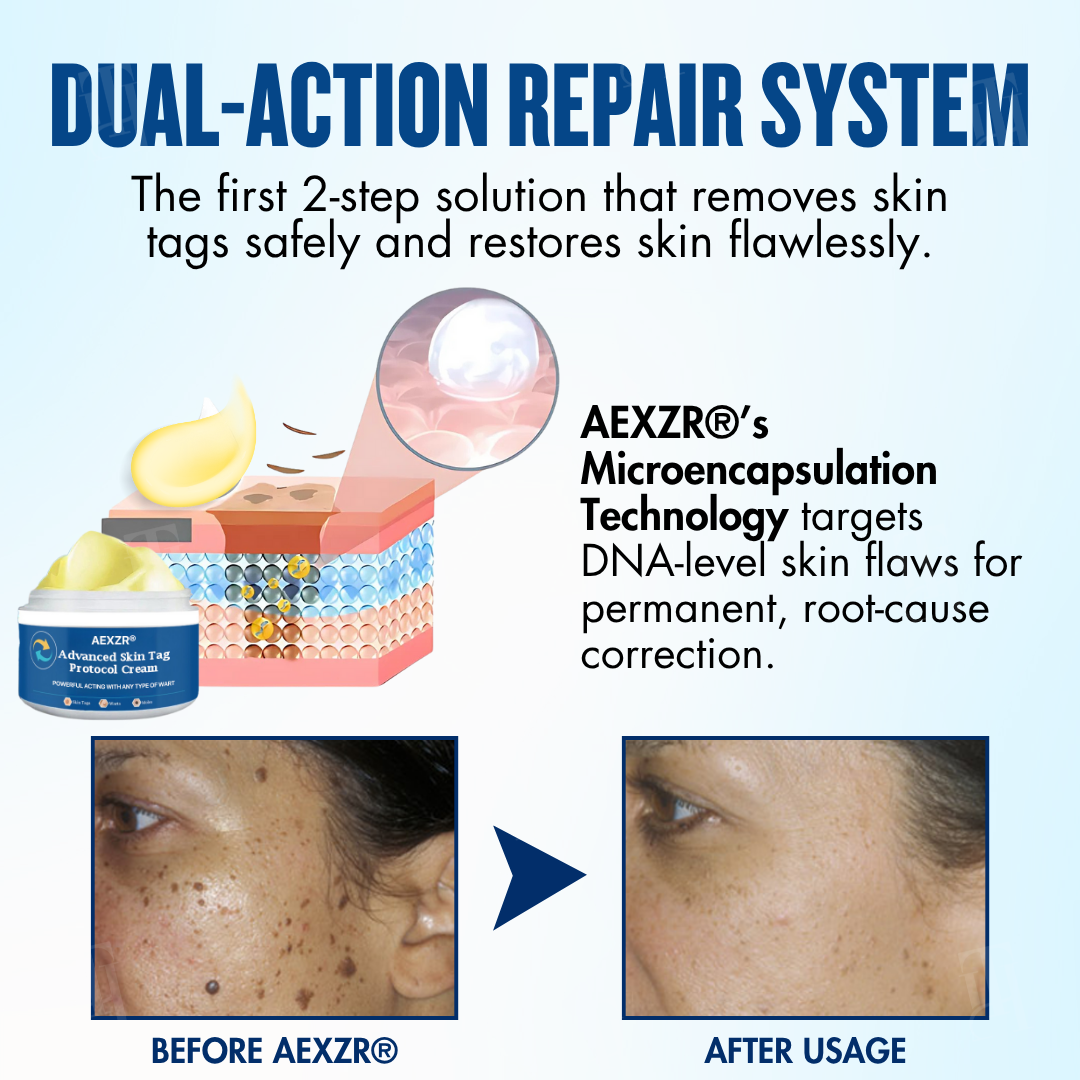 AEXZR® Advanced Skin Tag Protocol Cream