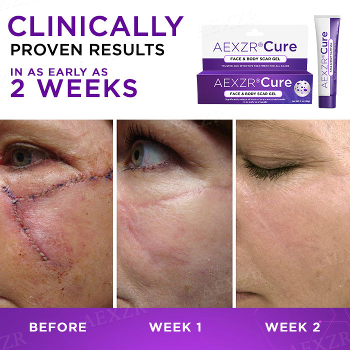 AEXZR® Cure Face & Body Scar Gel✨Skin Stories Rewritten