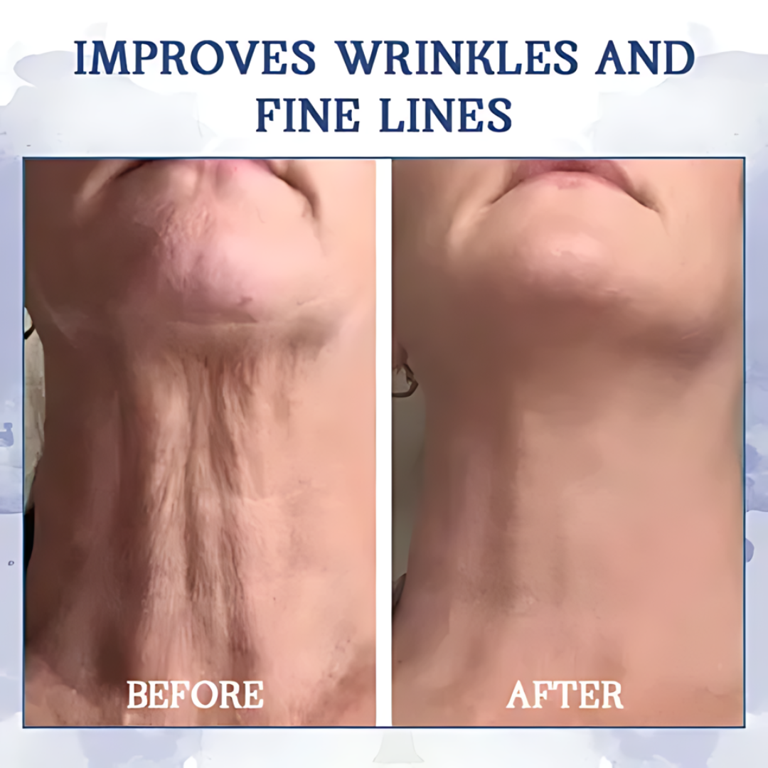 AEXZR® Advanced Firming & Wrinkle-Reducing Cream🚀 Age-Defying Body Transformation