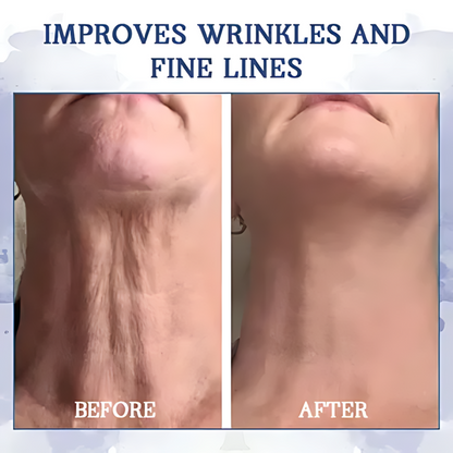 AEXZR® Advanced Firming & Wrinkle-Reducing Cream🚀 Age-Defying Body Transformation