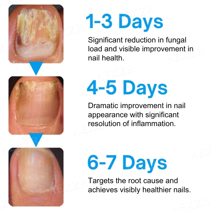 AEXZR® NanoFix Nail Repair Pen 🧬 *The Nano-Penetration System: Eradicates Fungus at The Root in Just 5 Days.*