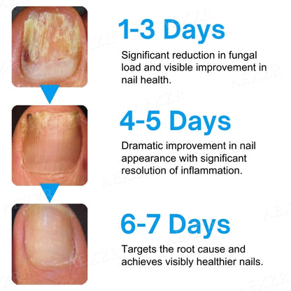 AEXZR® NanoFix Nail Repair Pen 🧬 *The Nano-Penetration System: Eradicates Fungus at The Root in Just 5 Days.*