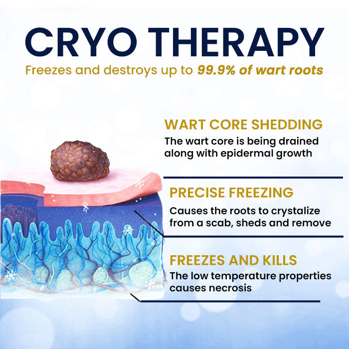 🥚 Easter Deal AEXZR® Skin Tag Cryo Treatment Spray🧊 Precision Cryo-Tech: Freezes Away Skin Tags & Warts in Seconds – No Blades, No Pain.