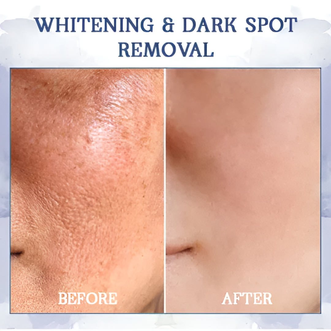 AEXZR® Advanced Firming & Wrinkle-Reducing Cream🚀 Age-Defying Body Transformation