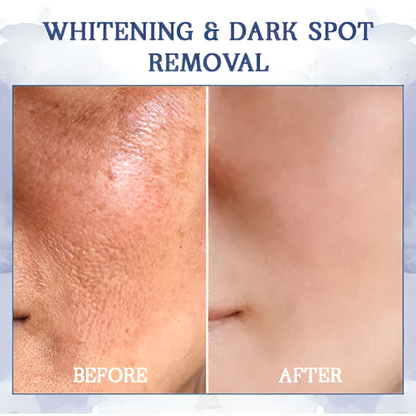 AEXZR® Advanced Firming & Wrinkle-Reducing Cream🚀 Age-Defying Body Transformation