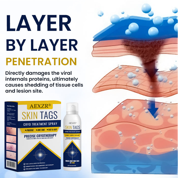 🥚 Easter Deal AEXZR® Skin Tag Cryo Treatment Spray🧊 Precision Cryo-Tech: Freezes Away Skin Tags & Warts in Seconds – No Blades, No Pain.