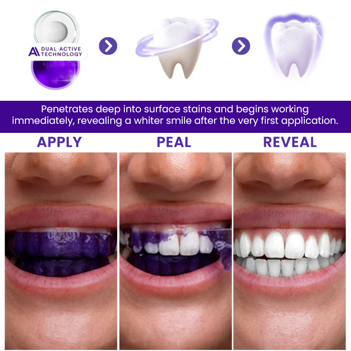 AEXZR® V34 Whitening Strips⚡ The 30-Minute White Rescue: See Results Before Your Mirror Fogs Up.