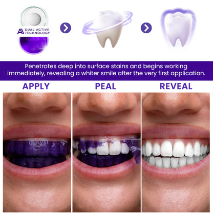 AEXZR® V34 Whitening Strips⚡ The 30-Minute White Rescue: See Results Before Your Mirror Fogs Up.