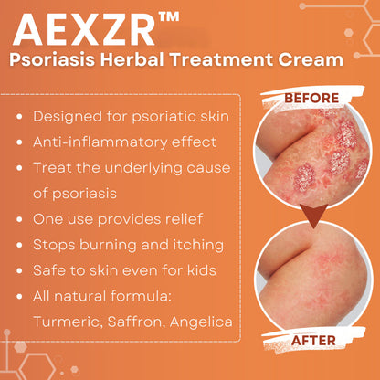 AEXZR™ Psoriasis Herbal Treatment Cream🧬 Dermatologist-Developed Biome Repair: Targets The Root Cause For 93% Reported Skin Recovery.