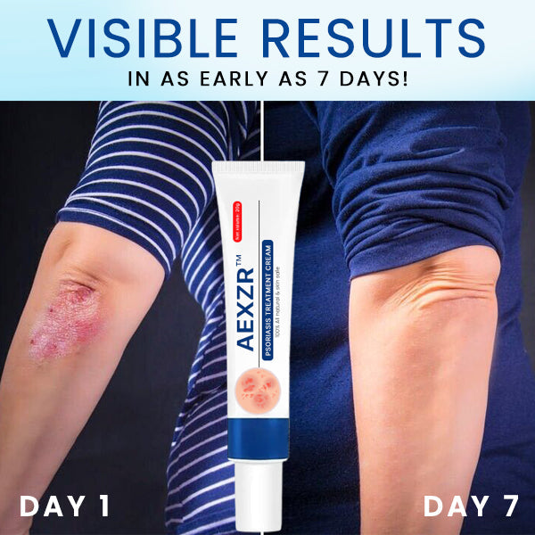 AEXZR™ Psoriasis Treatment Cream🌿 Dermatologist-Developed Herbal Formula: Targets Inflammation at The Root for Lasting Relief.