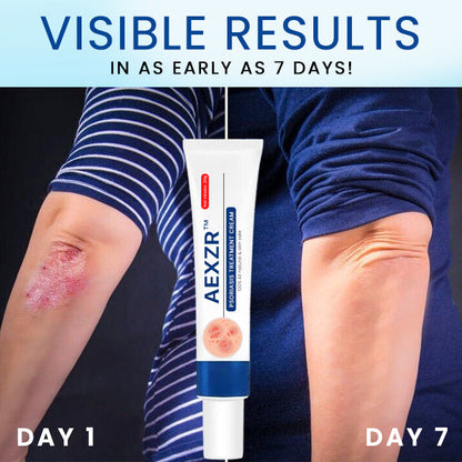 AEXZR™ Psoriasis Treatment Cream🌿 Dermatologist-Developed Herbal Formula: Targets Inflammation at The Root for Lasting Relief.